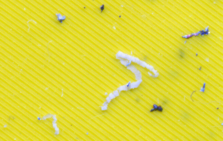 Partikel auf Filtermembran